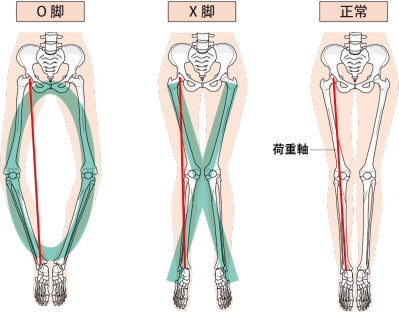 膝痛が楽になる整体 階段 小走り 外出の不安がなくなる 高槻市の整体院なら女性専門の整体院天使のわ