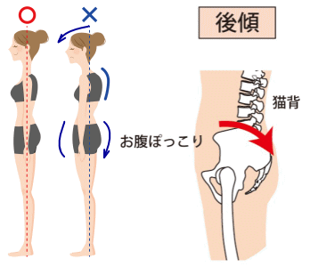 猫背の改善と整体 姿勢が良くなり体が楽になる | 高槻市の整体院なら女性専門の整体院天使のわ